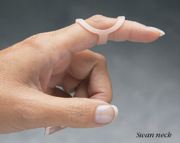 Oval 8 Refills Finger Splints