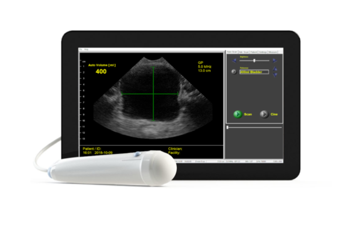 Interson Tablet View Bladder Scanner 10